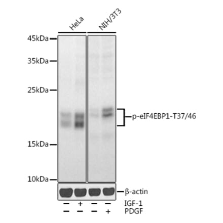Western Blot - Anti-eIF4EBP1 (phospho Thr37 + Thr46) Antibody (A16402) - Antibodies.com