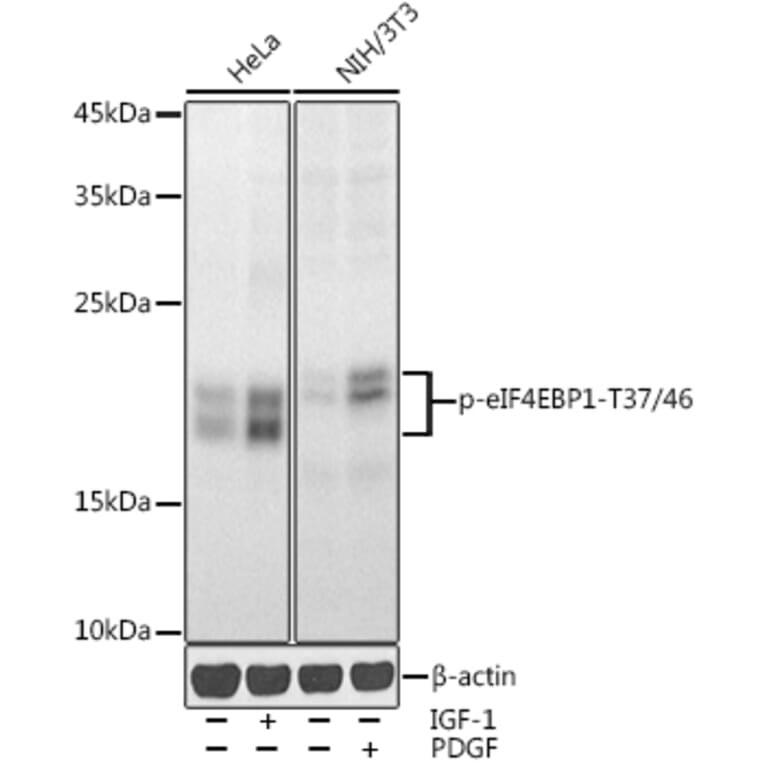 Western Blot - Anti-eIF4EBP1 (phospho Thr37 + Thr46) Antibody (A16402) - Antibodies.com