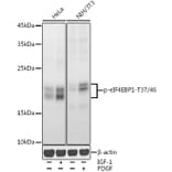 Western Blot - Anti-eIF4EBP1 (phospho Thr37 + Thr46) Antibody (A16402) - Antibodies.com
