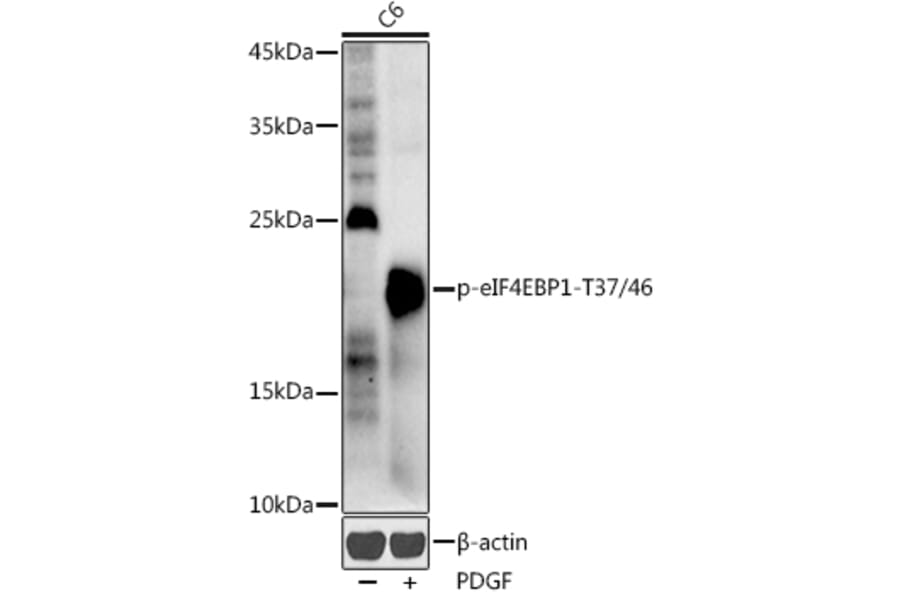 Western Blot - Anti-eIF4EBP1 (phospho Thr37 + Thr46) Antibody (A16402) - Antibodies.com