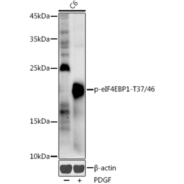 Western Blot - Anti-eIF4EBP1 (phospho Thr37 + Thr46) Antibody (A16402) - Antibodies.com