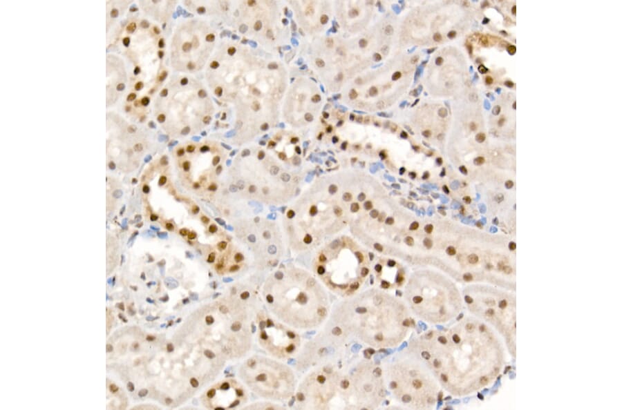 Immunohistochemistry - Anti-eIF4EBP1 (phospho Thr37 + Thr46) Antibody (A16402) - Antibodies.com