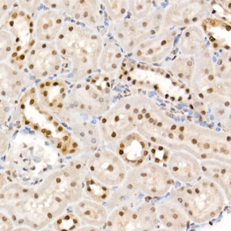 Immunohistochemistry - Anti-eIF4EBP1 (phospho Thr37 + Thr46) Antibody (A16402) - Antibodies.com