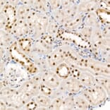 Immunohistochemistry - Anti-eIF4EBP1 (phospho Thr37 + Thr46) Antibody (A16402) - Antibodies.com