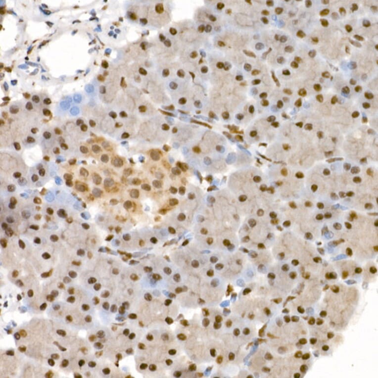 Immunohistochemistry - Anti-eIF4EBP1 (phospho Thr37 + Thr46) Antibody (A16402) - Antibodies.com