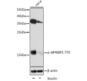 Western Blot - Anti-eIF4EBP1 (phospho Thr70) Antibody (A16403) - Antibodies.com