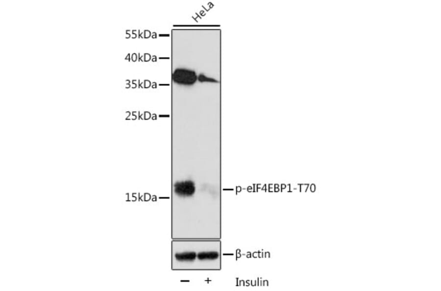 Western Blot - Anti-eIF4EBP1 (phospho Thr70) Antibody (A16403) - Antibodies.com