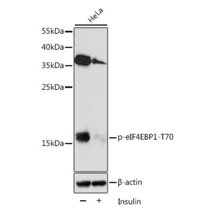 Western Blot - Anti-eIF4EBP1 (phospho Thr70) Antibody (A16403) - Antibodies.com