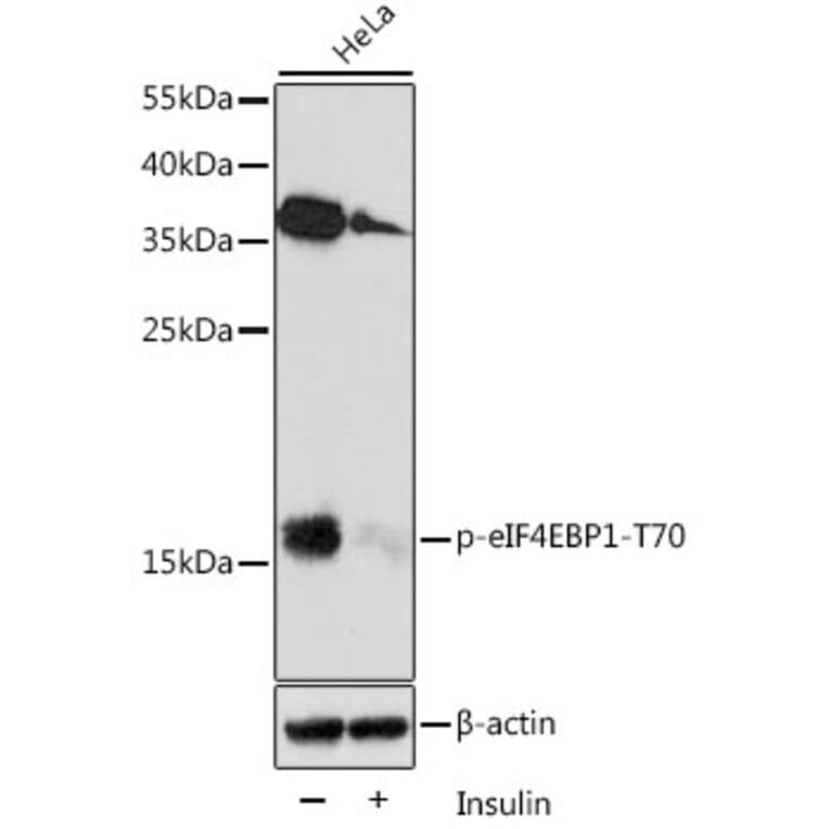 Western Blot - Anti-eIF4EBP1 (phospho Thr70) Antibody (A16403) - Antibodies.com