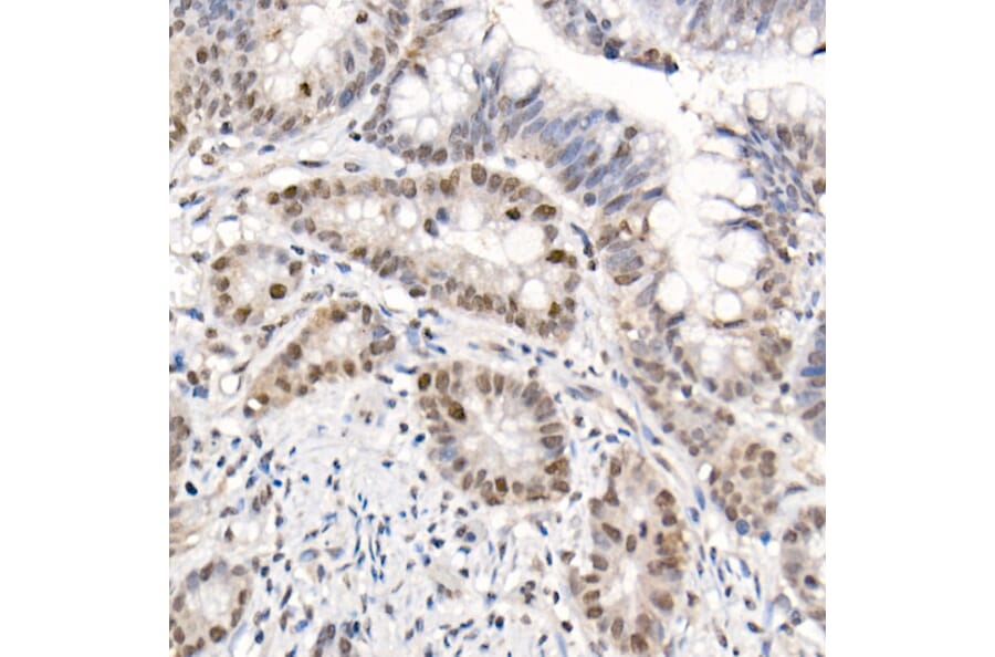 Immunohistochemistry - Anti-eIF4EBP1 (phospho Thr70) Antibody (A16403) - Antibodies.com