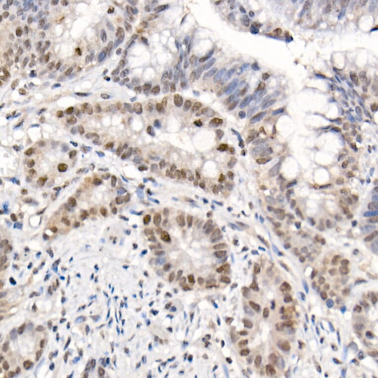 Immunohistochemistry - Anti-eIF4EBP1 (phospho Thr70) Antibody (A16403) - Antibodies.com