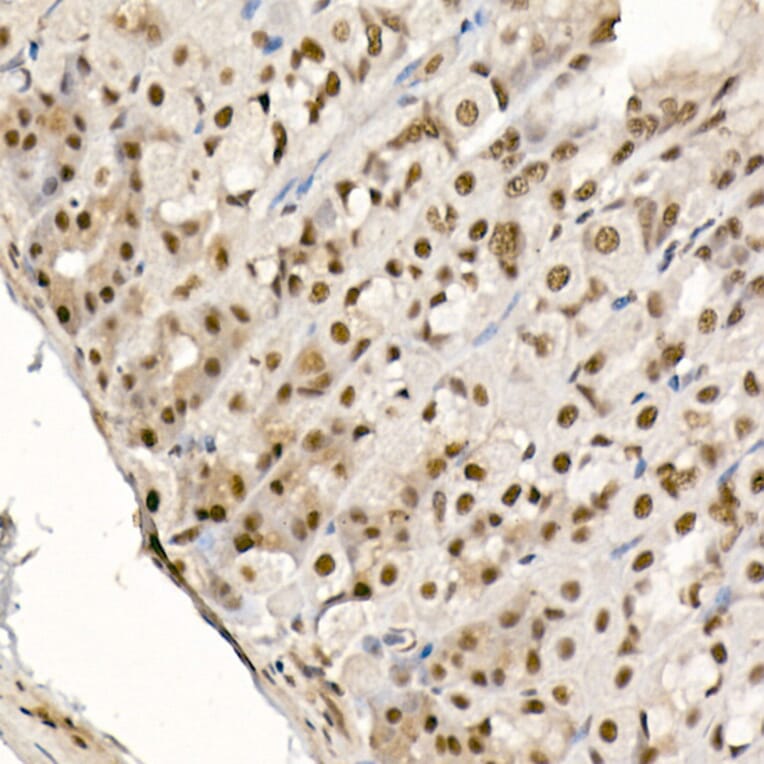 Immunohistochemistry - Anti-eIF4EBP1 (phospho Thr70) Antibody (A16403) - Antibodies.com