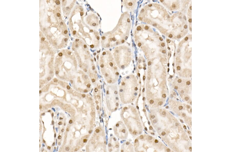 Immunohistochemistry - Anti-eIF4EBP1 (phospho Thr70) Antibody (A16403) - Antibodies.com