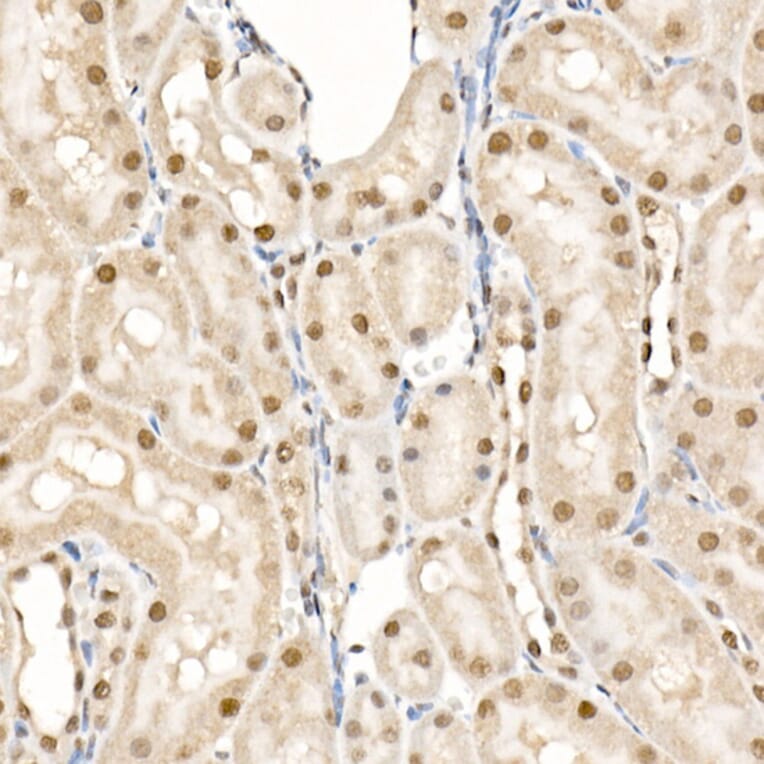 Immunohistochemistry - Anti-eIF4EBP1 (phospho Thr70) Antibody (A16403) - Antibodies.com