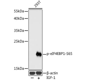 Western Blot - Anti-eIF4EBP1 (phospho Ser65) Antibody (A16404) - Antibodies.com