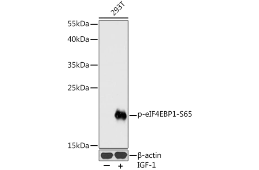 Western Blot - Anti-eIF4EBP1 (phospho Ser65) Antibody (A16404) - Antibodies.com
