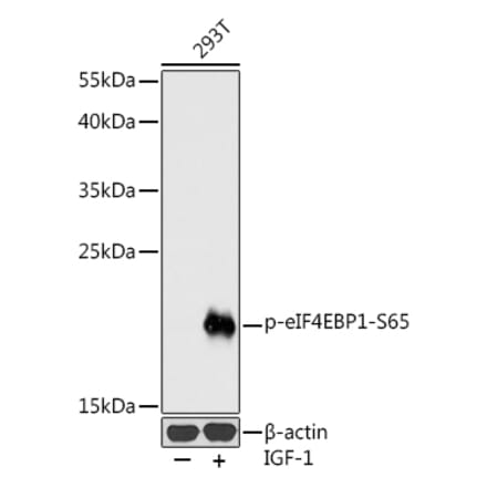 Western Blot - Anti-eIF4EBP1 (phospho Ser65) Antibody (A16404) - Antibodies.com