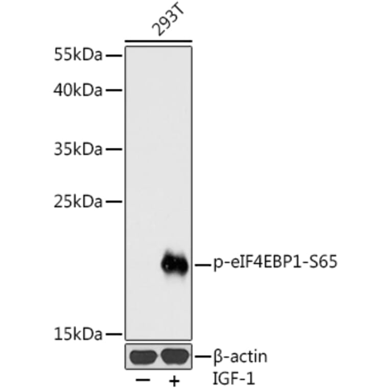 Western Blot - Anti-eIF4EBP1 (phospho Ser65) Antibody (A16404) - Antibodies.com
