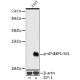 Western Blot - Anti-eIF4EBP1 (phospho Ser65) Antibody (A16404) - Antibodies.com
