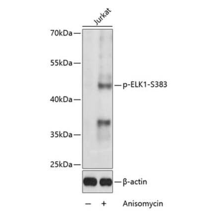 Western Blot - Anti-ELK1 (phospho Ser383) Antibody (A16405) - Antibodies.com