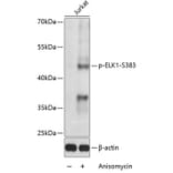 Western Blot - Anti-ELK1 (phospho Ser383) Antibody (A16405) - Antibodies.com