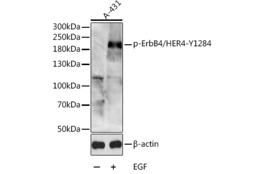 Western Blot - Anti-ErbB4/HER4 (phospho Tyr1284) Antibody (A16406) - Antibodies.com