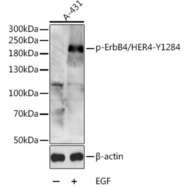 Western Blot - Anti-ErbB4/HER4 (phospho Tyr1284) Antibody (A16406) - Antibodies.com