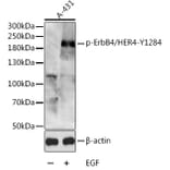 Western Blot - Anti-ErbB4/HER4 (phospho Tyr1284) Antibody (A16406) - Antibodies.com