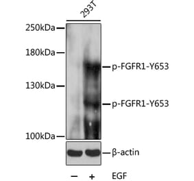 Western Blot - Anti-FGFR1 (phospho Tyr653) Antibody (A16407) - Antibodies.com