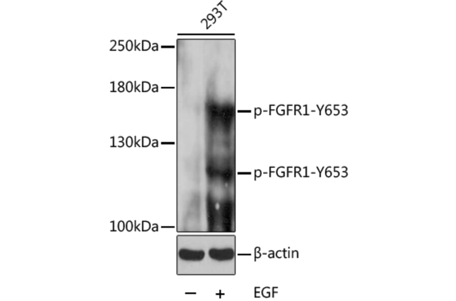 Western Blot - Anti-FGFR1 (phospho Tyr653) Antibody (A16407) - Antibodies.com