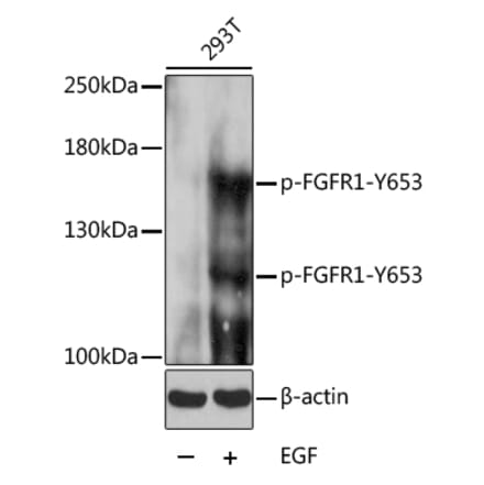 Western Blot - Anti-FGFR1 (phospho Tyr653) Antibody (A16407) - Antibodies.com