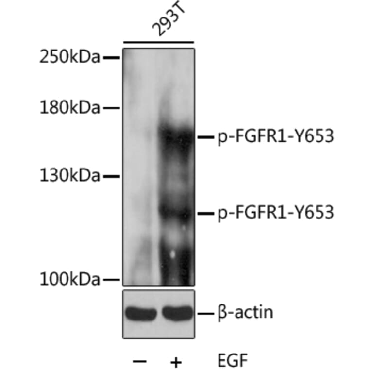 Western Blot - Anti-FGFR1 (phospho Tyr653) Antibody (A16407) - Antibodies.com