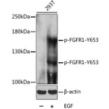 Western Blot - Anti-FGFR1 (phospho Tyr653) Antibody (A16407) - Antibodies.com