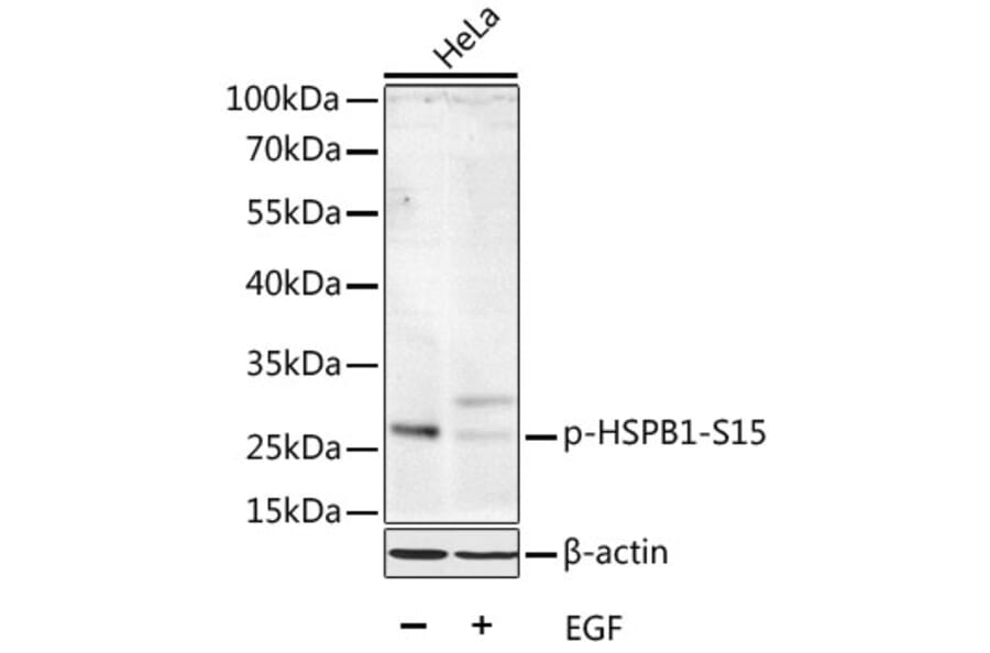 Western Blot - Anti-HSPB1 (phospho S15) Antibody (AP0040) - Antibodies.com