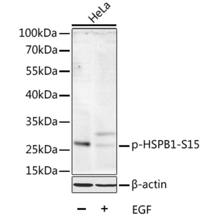 Western Blot - Anti-HSPB1 (phospho S15) Antibody (AP0040) - Antibodies.com