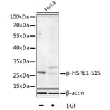 Western Blot - Anti-HSPB1 (phospho S15) Antibody (AP0040) - Antibodies.com