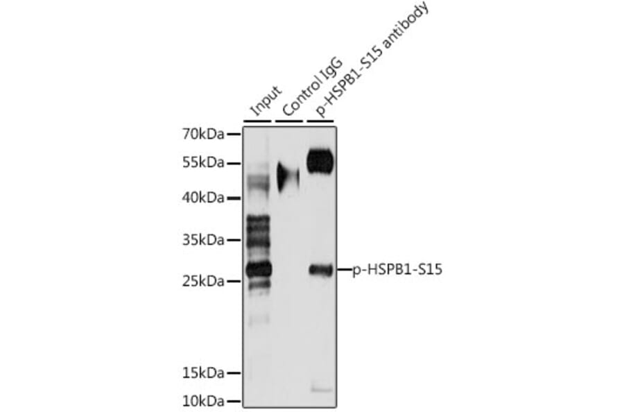 Immunoprecipitation - Anti-HSPB1 (phospho S15) Antibody (AP0040) - Antibodies.com