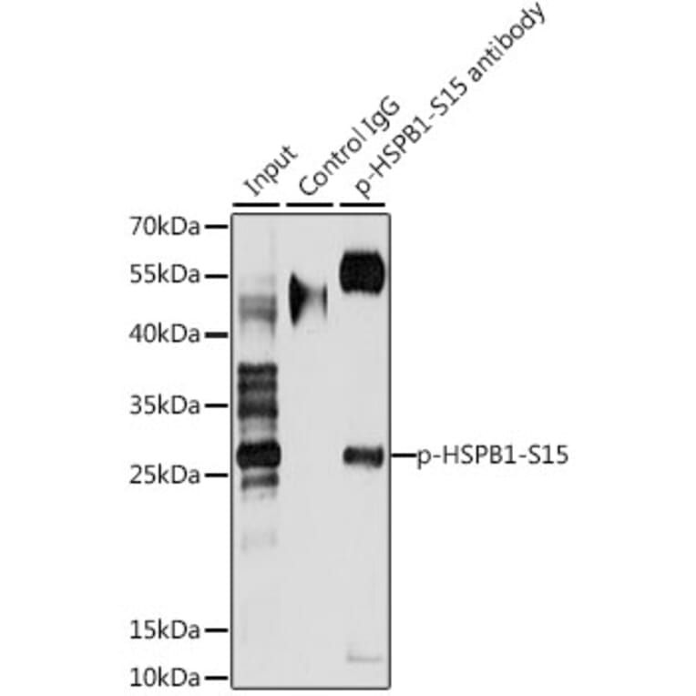 Immunoprecipitation - Anti-HSPB1 (phospho S15) Antibody (AP0040) - Antibodies.com