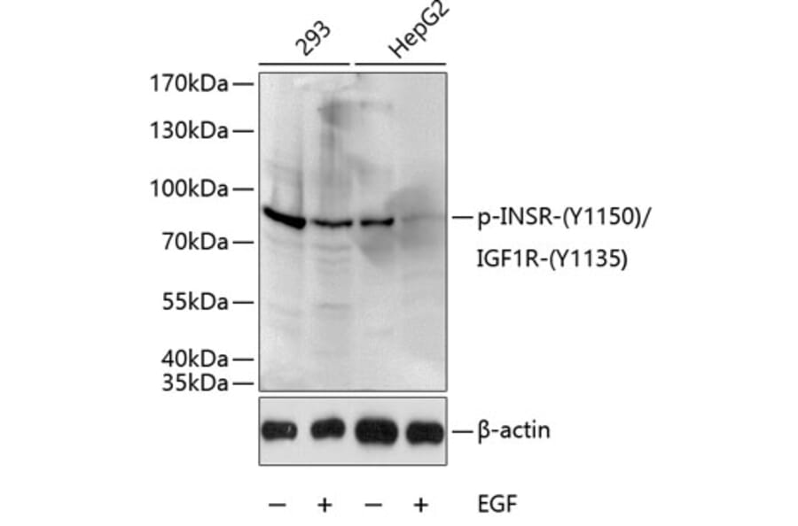 Western Blot - Anti-Insulin Receptor (phospho Tyr1150) + IGF1 Receptor (phospho Tyr1135) Antibody (A16411) - Antibodies.com