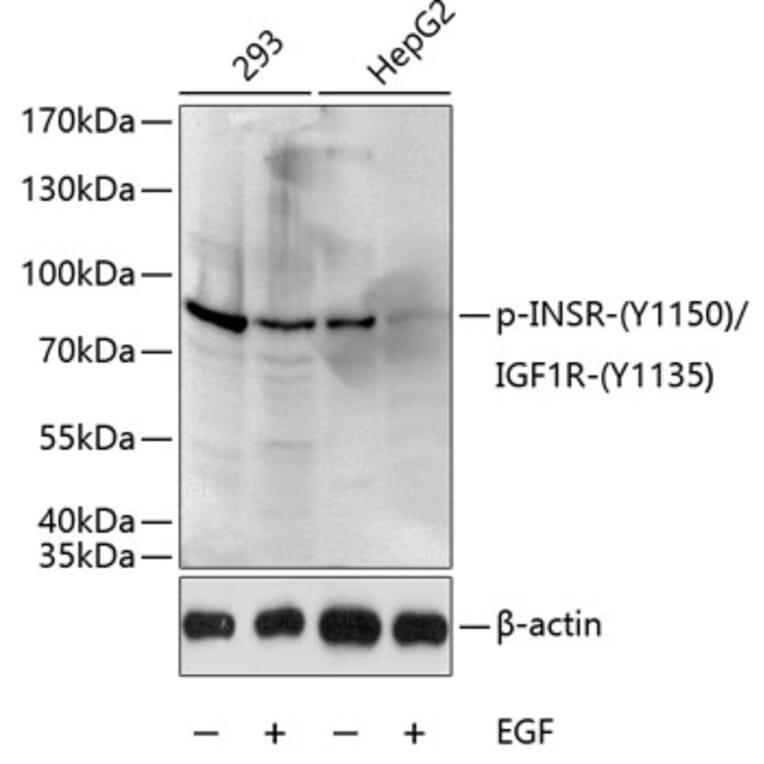 Western Blot - Anti-Insulin Receptor (phospho Tyr1150) + IGF1 Receptor (phospho Tyr1135) Antibody (A16411) - Antibodies.com