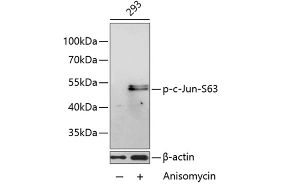 Western Blot - Anti-c-Jun (phospho Ser63) Antibody (A16415) - Antibodies.com