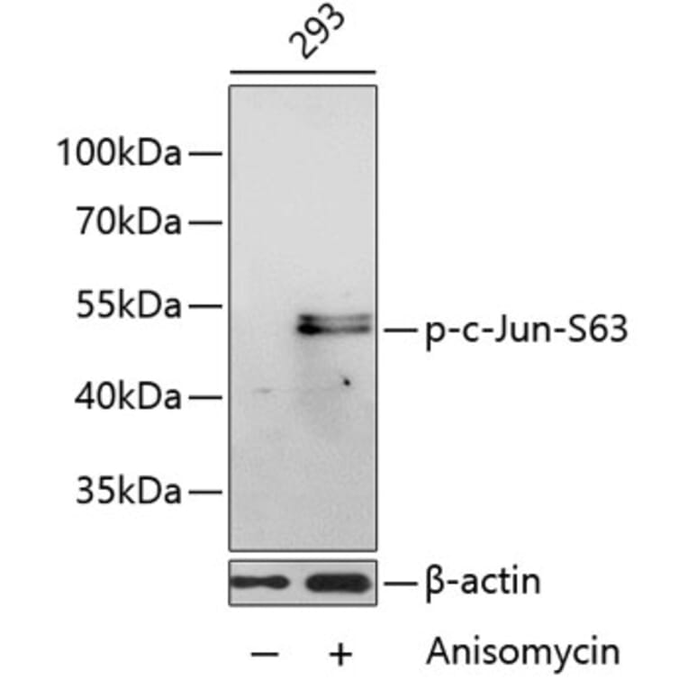 Western Blot - Anti-c-Jun (phospho Ser63) Antibody (A16415) - Antibodies.com