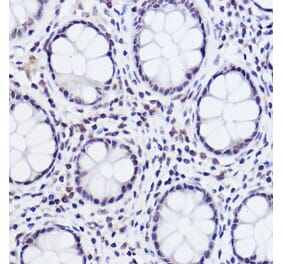Immunohistochemistry - Anti-c-Jun (phospho Ser243) Antibody (A16416) - Antibodies.com