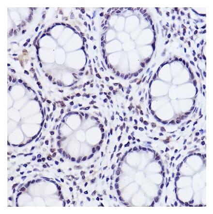 Immunohistochemistry - Anti-c-Jun (phospho Ser243) Antibody (A16416) - Antibodies.com