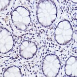 Immunohistochemistry - Anti-c-Jun (phospho Ser243) Antibody (A16416) - Antibodies.com