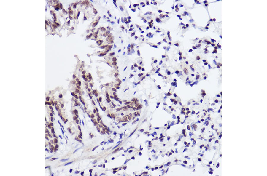 Immunohistochemistry - Anti-c-Jun (phospho Ser243) Antibody (A16416) - Antibodies.com
