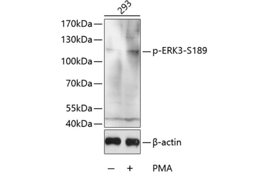 Western Blot - Anti-MAPK6/ERK3 (phospho Ser189) Antibody (A16417) - Antibodies.com