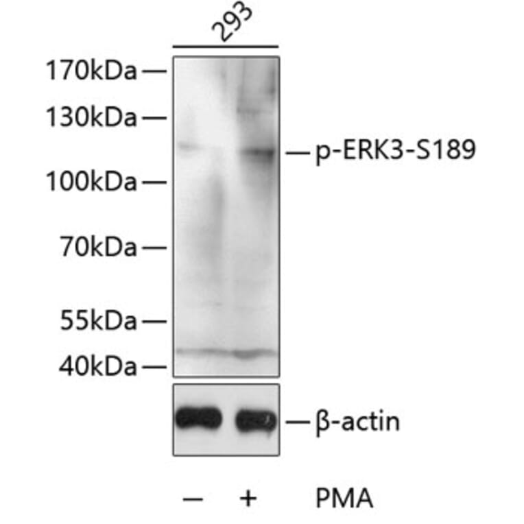 Western Blot - Anti-MAPK6/ERK3 (phospho Ser189) Antibody (A16417) - Antibodies.com