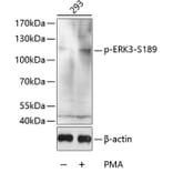 Western Blot - Anti-MAPK6/ERK3 (phospho Ser189) Antibody (A16417) - Antibodies.com
