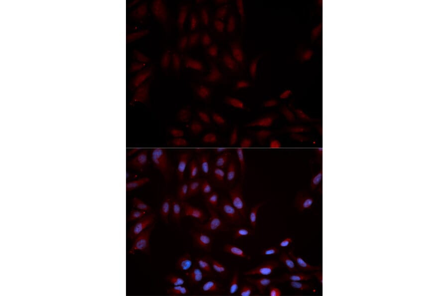Immunofluorescence - Anti-MAPK14 (phospho Y322) Antibody (AP0055) - Antibodies.com